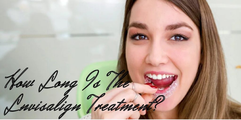 How Long Is The Lnvisalign Treatment?
